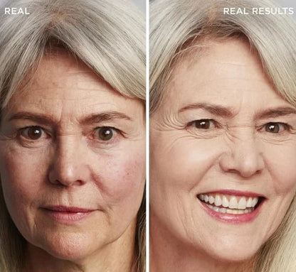 🔥2026 Hot Sale 50% OFF✨⚡ 50K+ SOLD! 🎁4-in-1 Perfecting Foundation – High Coverage, SPF & All-Day Hydration 🤍✨