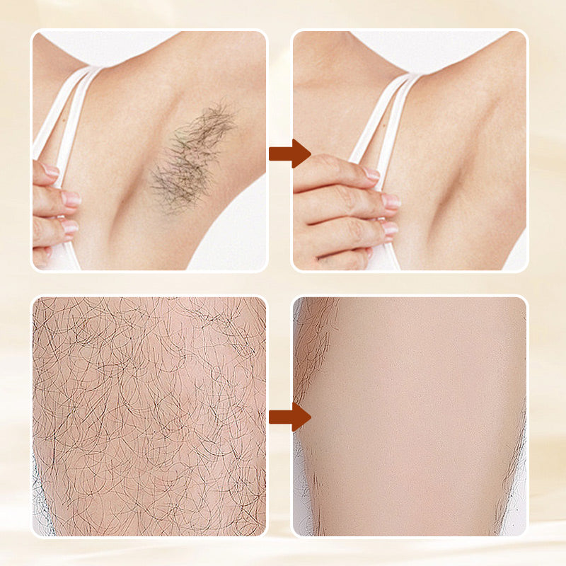 🔥HOT SALE 49% OFF🔥Versatile Aromatic  Hair Removal Cream 💥