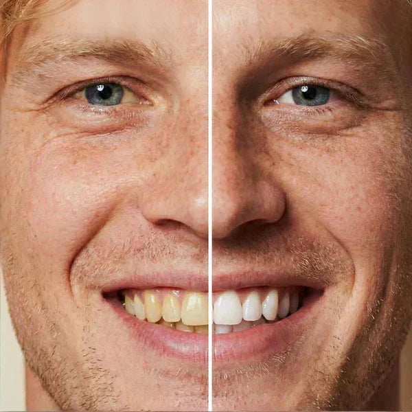 🏆Flash Sale⚡ 50K+ SOLD! 🔥5ml Instant Whitening Tooth Paint