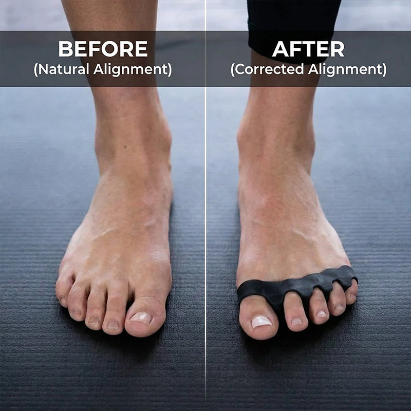 🌟40% Off!🦶Reusable & Washable Foot Alignment Correctors✨