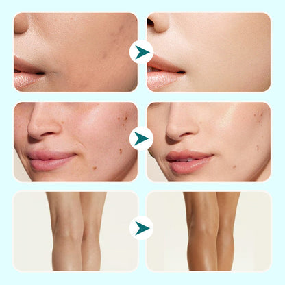 🎁New arrival 49% OFF💥Moisturizing Concealer Waterproof Cream For Women
