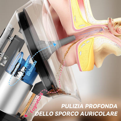 🔥HOT SALE⚡Wireless ear washer ✨ Adjustable pressure, with LED screen, one-button rinse, clean and comfortable 🌊