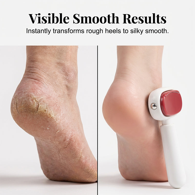 ✨📢LAST DAY SALE: Only ￡9.99!!!🔥Double-Sided Foot Scraper for Callus Removal